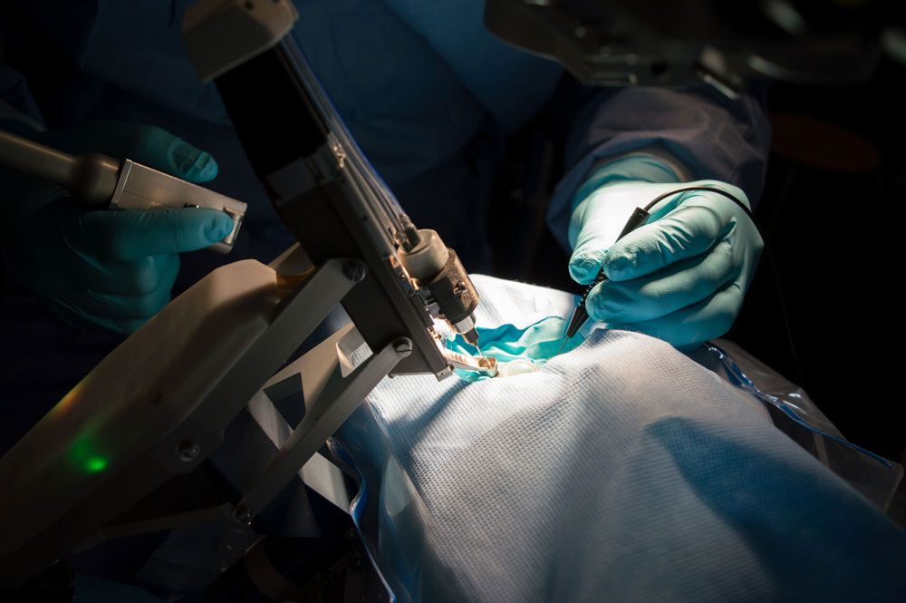 PRECEYES Surgical System
