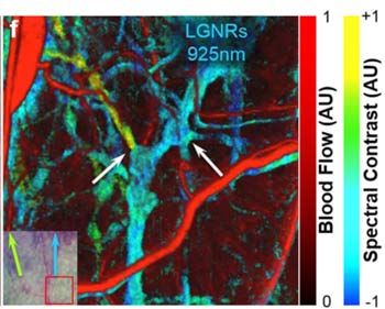 Figure 2.  A junction in the lymph network.