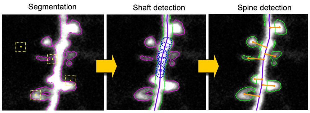 Figure 4. Dendrite images processed with early versions of Spine Tool.