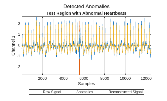 Detect Anomalies in Signals Using deepSignalAnomalyDetector