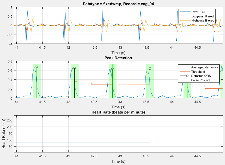 parfor-plot-good-ecg_04.png