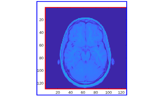 Figure contains an axes object. The axes object contains an object of type image.