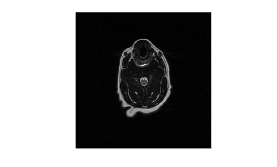 Create Image Datastore Containing DICOM Images