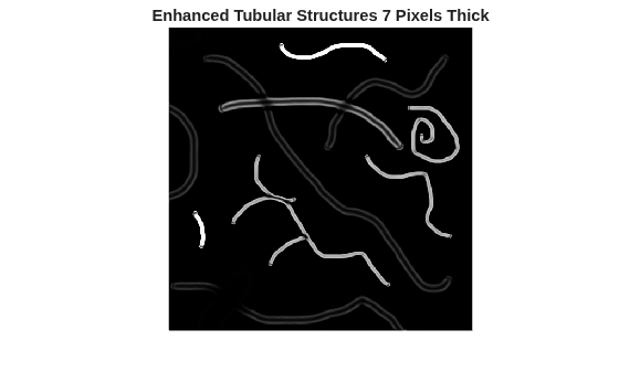 Figure contains an axes object. The hidden axes object with title Enhanced Tubular Structures 7 Pixels Thick contains an object of type image.