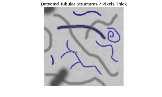 Figure contains an axes object. The hidden axes object with title Detected Tubular Structures 7 Pixels Thick contains an object of type image.