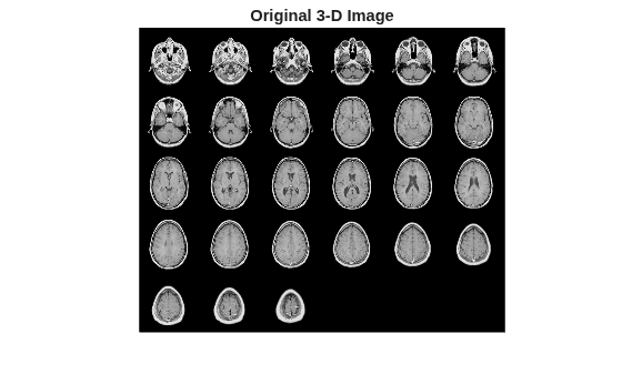 Figure contains an axes object. The hidden axes object with title Original 3-D Image contains an object of type image.