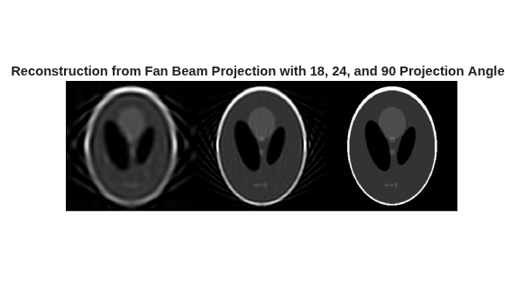Figure contains an axes object. The hidden axes object with title Reconstruction from Fan Beam Projection with 18, 24, and 90 Projection Angles contains an object of type image.