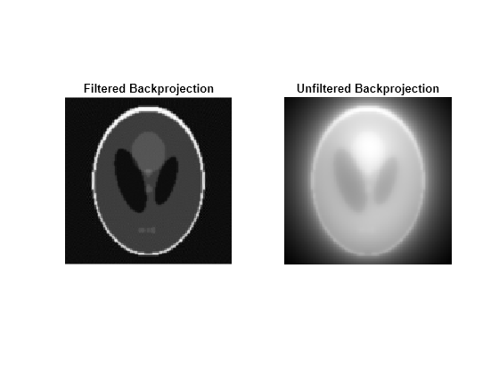 Figure contains 2 axes objects. Hidden axes object 1 with title Filtered Backprojection contains an object of type image. Hidden axes object 2 with title Unfiltered Backprojection contains an object of type image.