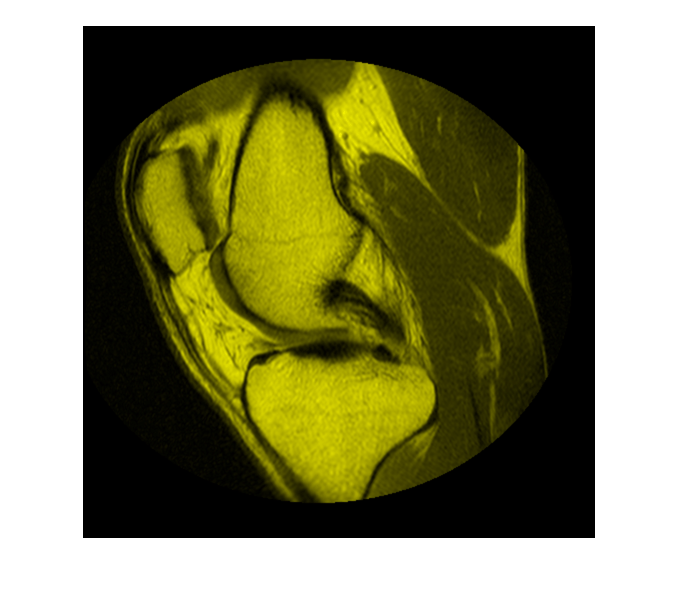 Figure contains an axes object. The hidden axes object contains an object of type image.