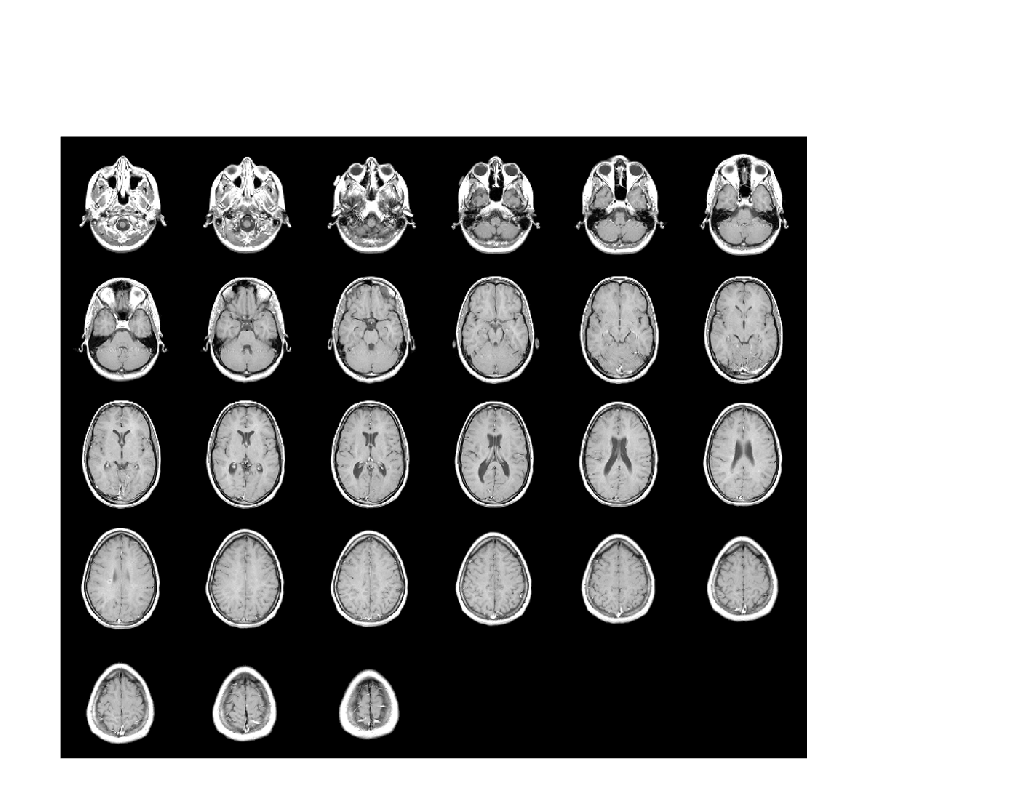 Figure contains an axes object. The hidden axes object contains an object of type image.