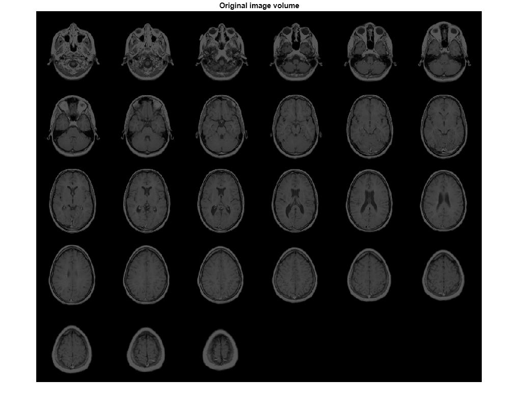 Figure contains an axes object. The hidden axes object with title Original image volume contains an object of type image.