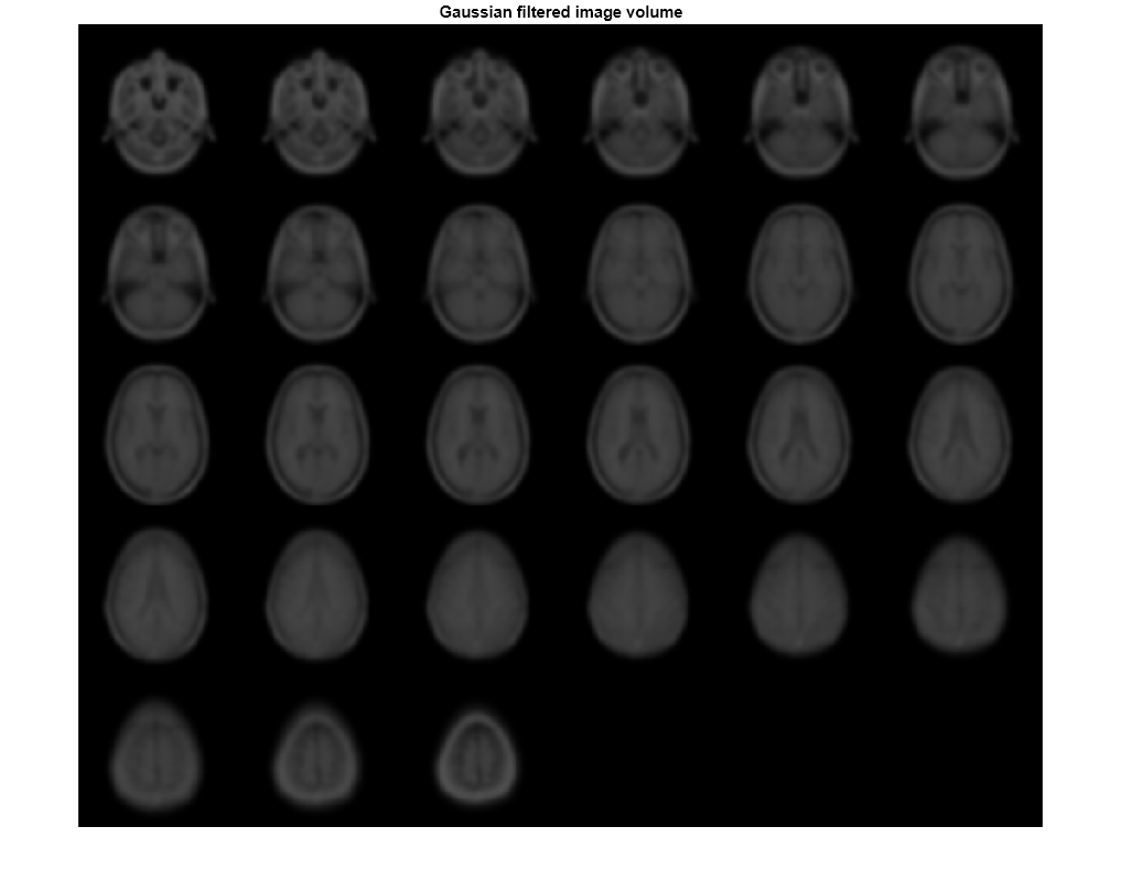 Figure contains an axes object. The hidden axes object with title Gaussian filtered image volume contains an object of type image.