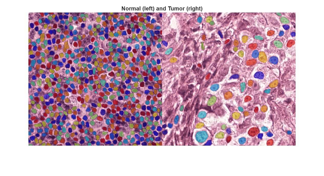 Classify Tumors in Digital Pathology Images Using Cell Nucleus Morphology