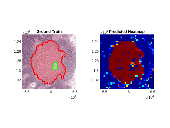 Classify Tumors in Multiresolution Blocked Images