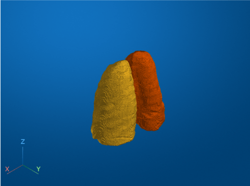 Segment Lungs from CT Scan Using Pretrained Neural Network