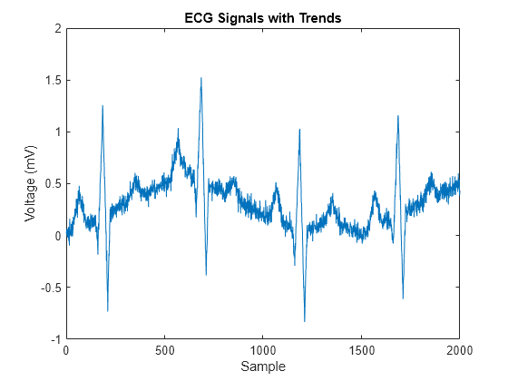 Figure contains an axes object. The axes object with title ECG Signals with Trends, xlabel Sample, ylabel Voltage (mV) contains an object of type line.