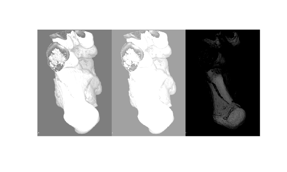 Figure contains an axes object. The hidden axes object contains an object of type image.