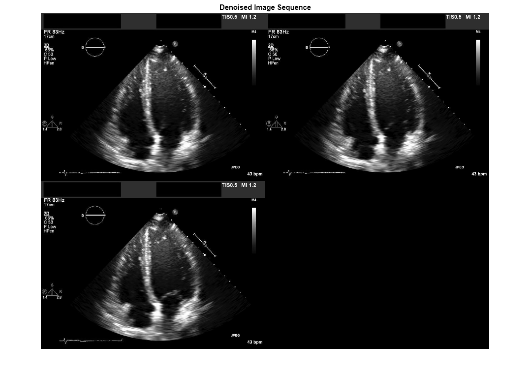 Figure contains an axes object. The hidden axes object with title Denoised Image Sequence contains an object of type image.