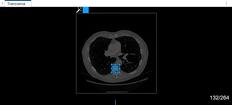 Bounding box adjustment in transverse view