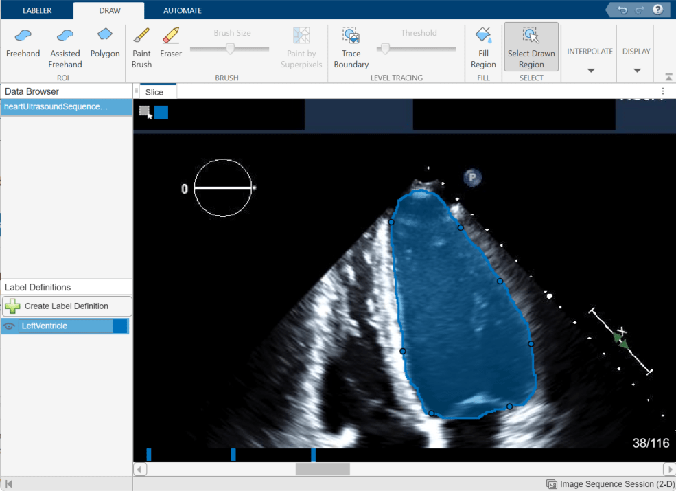 Select the ventricle label region in slice 38