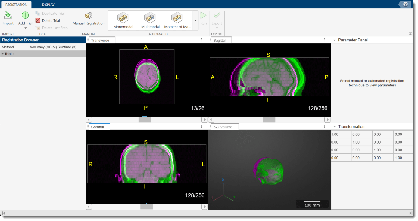 Medical Registration Estimator app window with the fixed and moving volumes loaded