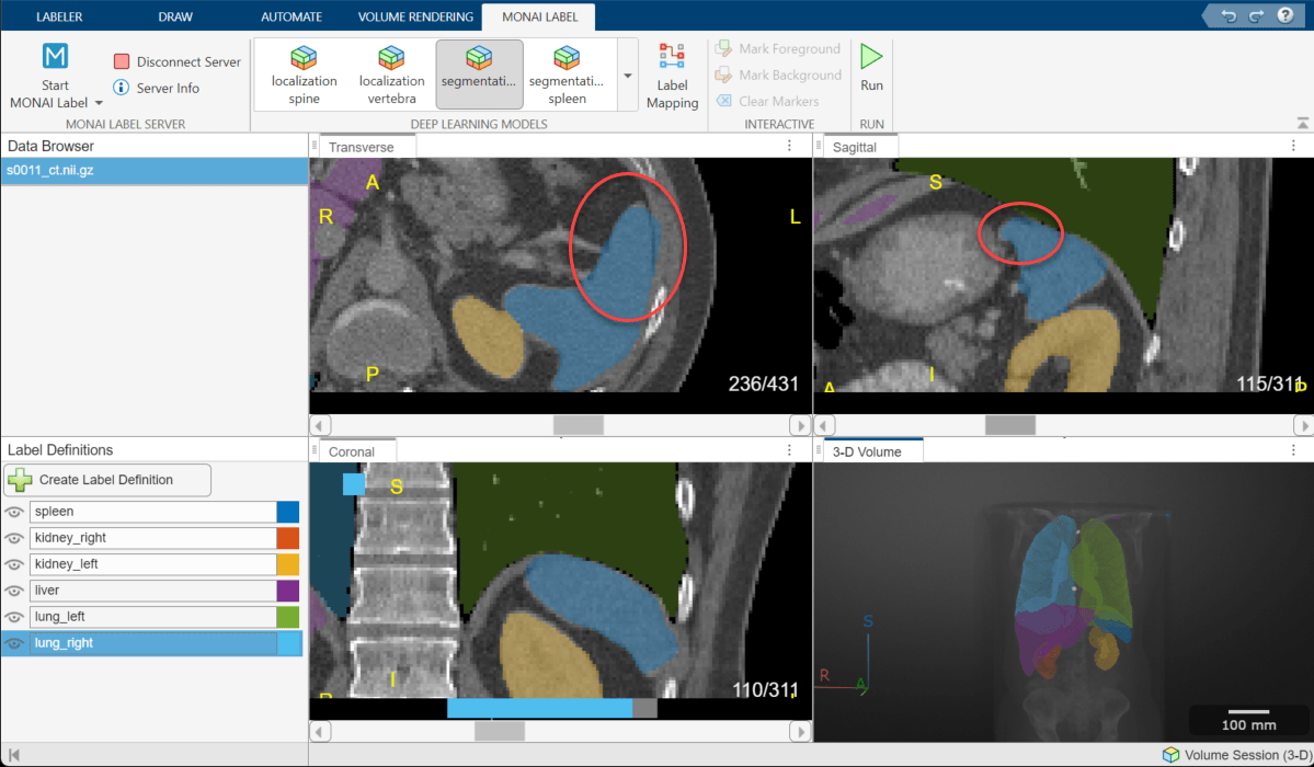 Label Mapping dialog box, showing mapping between the spleen label from the segmentation spleen MONAI Label model and the existing spleen label definition.