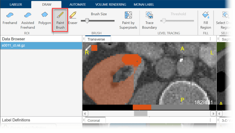 Manually refine the right kidney label by using the paintbrush tool in the Draw tab.