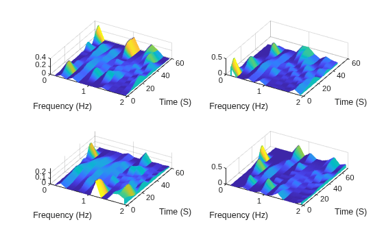 Figure contains 4 axes objects. Axes object 1 with xlabel Frequency (Hz), ylabel Time (S) contains an object of type patch. Axes object 2 with xlabel Frequency (Hz), ylabel Time (S) contains an object of type patch. Axes object 3 with xlabel Frequency (Hz), ylabel Time (S) contains an object of type patch. Axes object 4 with xlabel Frequency (Hz), ylabel Time (S) contains an object of type patch.
