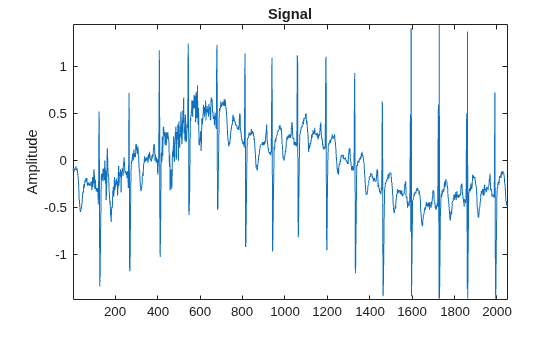 Figure contains an axes object. The axes object with title Signal, ylabel Amplitude contains an object of type line.
