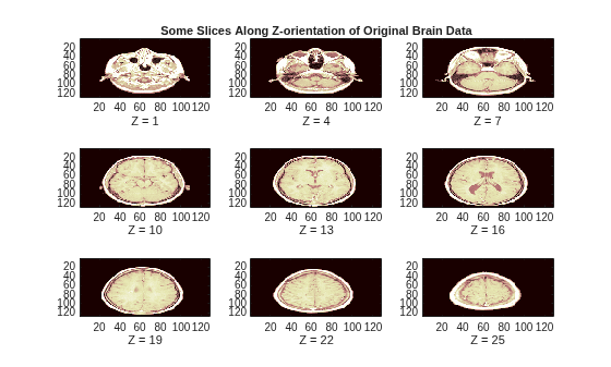Figure contains 9 axes objects. Axes object 1 with xlabel Z = 1 contains an object of type image. Axes object 2 with title Some Slices Along Z-orientation of Original Brain Data, xlabel Z = 4 contains an object of type image. Axes object 3 with xlabel Z = 7 contains an object of type image. Axes object 4 with xlabel Z = 10 contains an object of type image. Axes object 5 with xlabel Z = 13 contains an object of type image. Axes object 6 with xlabel Z = 16 contains an object of type image. Axes object 7 with xlabel Z = 19 contains an object of type image. Axes object 8 with xlabel Z = 22 contains an object of type image. Axes object 9 with xlabel Z = 25 contains an object of type image.