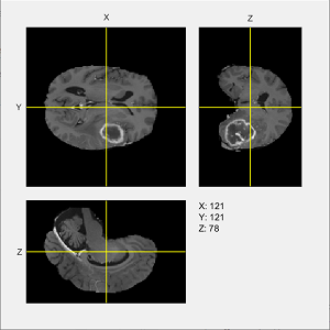 Three orthogonal cross-sections of a 3-D volumetric image, with interactive yellow lines on each cross-section that show and control the position of the other planes.