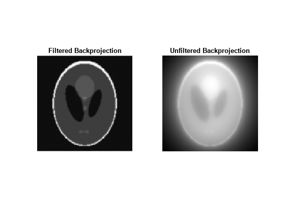 Figure contains 2 axes objects. Axes object 1 with title Filtered Backprojection contains an object of type image. Axes object 2 with title Unfiltered Backprojection contains an object of type image.