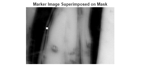 Figure contains an axes object. The hidden axes object with title Marker Image Superimposed on Mask contains an object of type image.