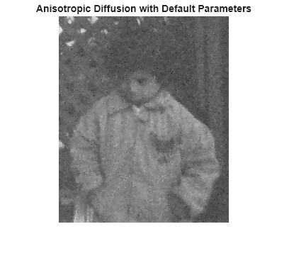 Figure contains an axes object. The hidden axes object with title Anisotropic Diffusion with Default Parameters contains an object of type image.