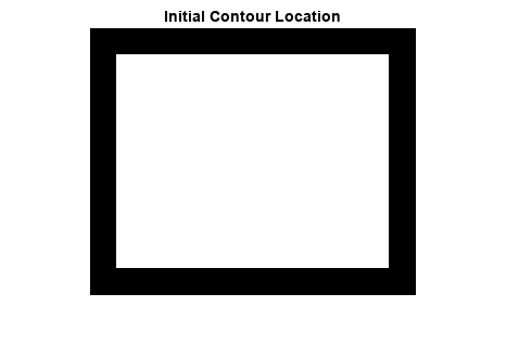Figure contains an axes object. The axes object with title Initial Contour Location contains an object of type image.
