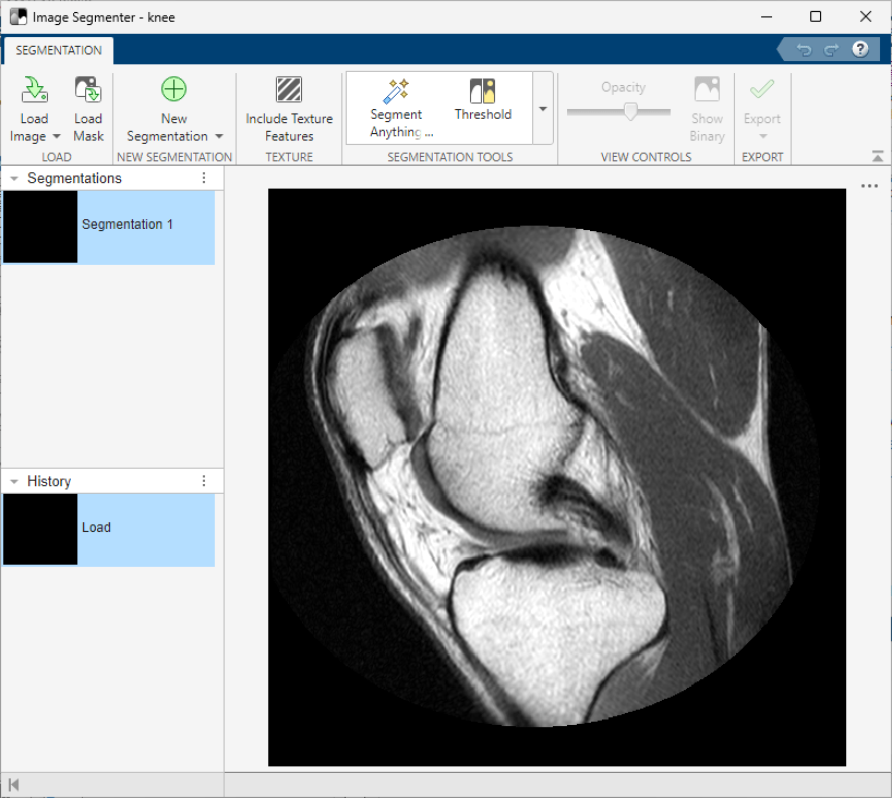 Image Segmenter app showing a scan of a human knee.