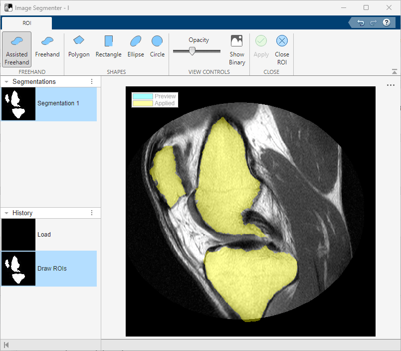 The ROI tab is open and knee scan has three segments defined that are now shaded in yellow.
