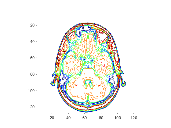 Cross section of a human head displayed as a contour plot that uses different colors for different features in the scan