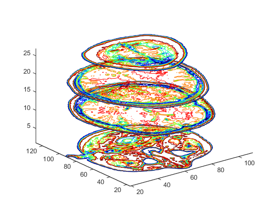 Four cross sections of a human head displayed as stacked contour plots in a 3-D coordinate space