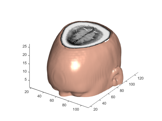 Surface plot showing a reconstruction of a partial human head with a cross-sectional image near the top of the head
