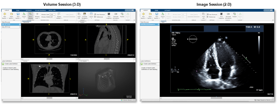 Side-by-side view of Medical Image Labeler app Volume session and Image session