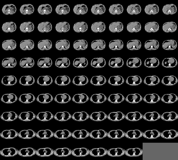 Display slices of a medical volume using the montage function