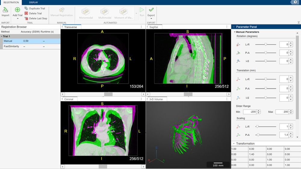 Ventana de la app Medical Registration Estimator que muestra la barra de herramientas, el navegador de registro, el panel de parámetros y cuatro imágenes cargadas.