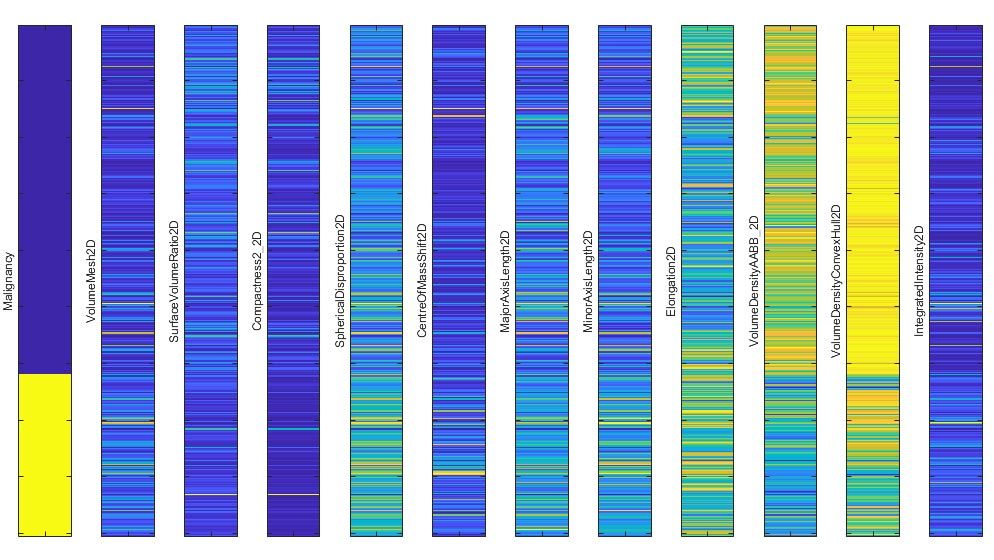 Características seleccionadas para clasificar tumores malignos