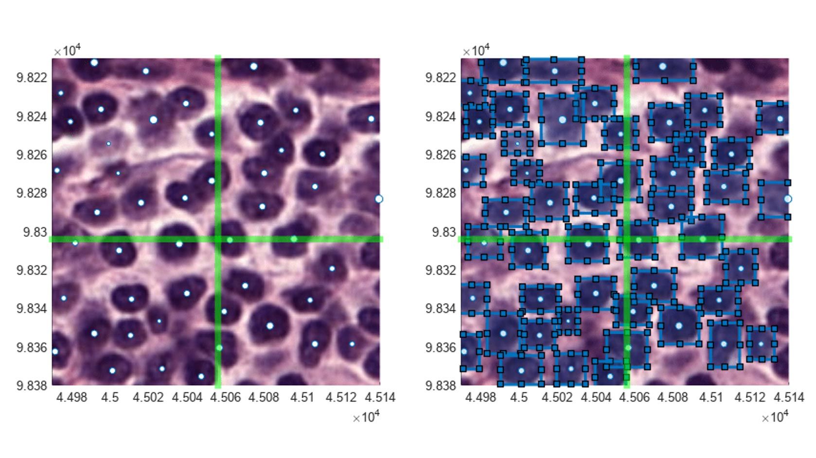 Núcleos celulares de tejido teñido con hematoxilina-eosina detectados con Cellpose
