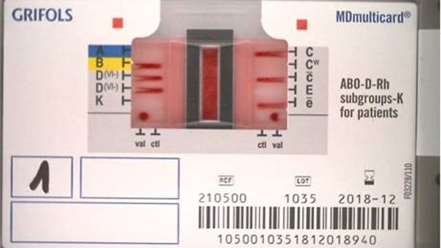 IDNEO desarrolla algoritmos integrados de visión artificial y Machine Learning para interpretar resultados del tipo de sangre