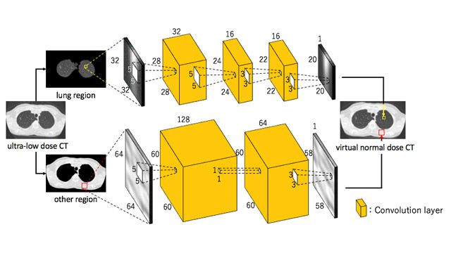 Uso de Deep Learning para reducir el riesgo de exposición a radiación al generar imágenes de TC